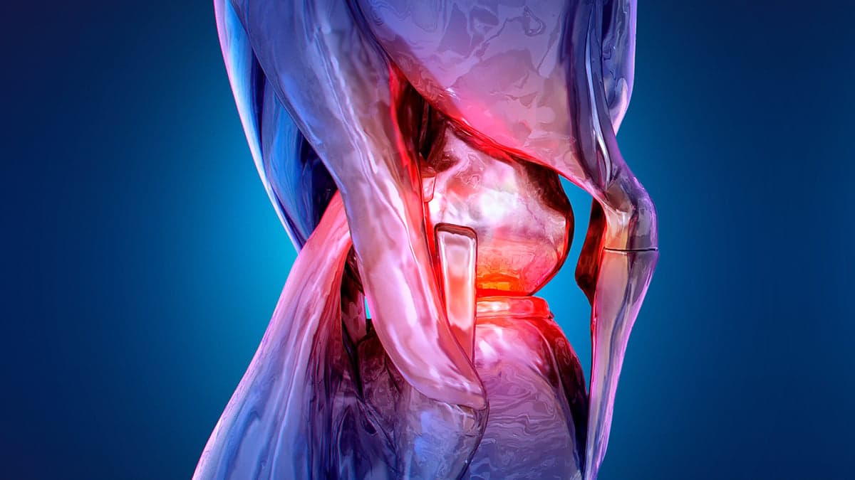 Non-surgical procedure reduces knee osteoarthritis pain by half in 12-month trial